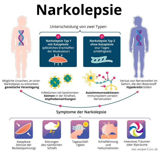 Narkolepsie: Eine tickende Zeitbombe oder harmloser Schlummer?