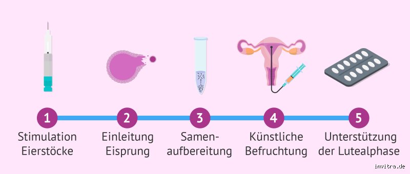 Künstliche Befruchtung als Single: Ist dieser Weg zur Mutterschaft heute wirklich gangbar?