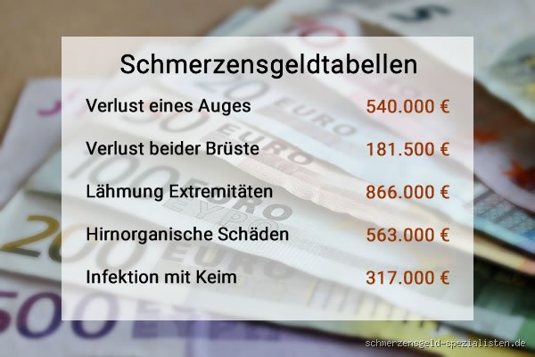 Was braucht man vom Arzt für Schmerzensgeld? Die entscheidenden Schritte und Tipps